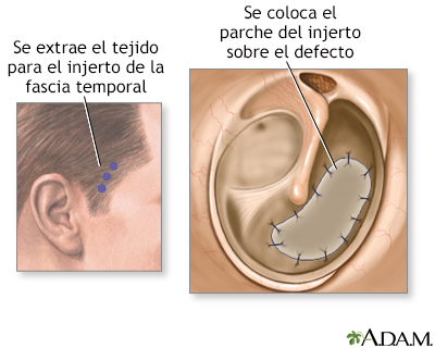 Procedimiento