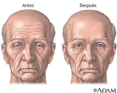 Cuidados postoperatorios