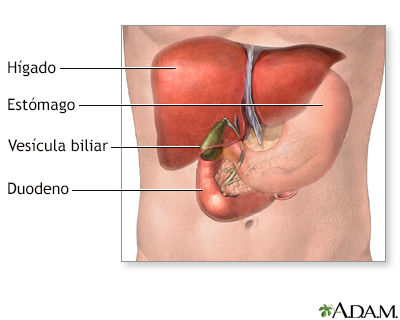 Colecistectomía - Serie