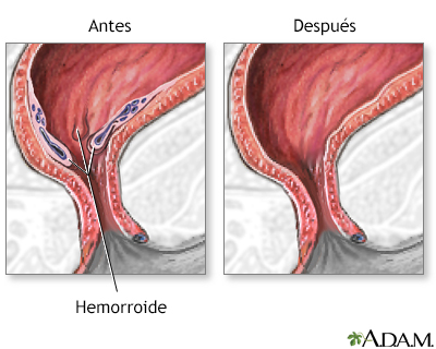 Cuidados postoperatorios