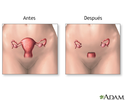 Cuidados postoperatorios