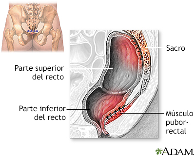 Procedimiento