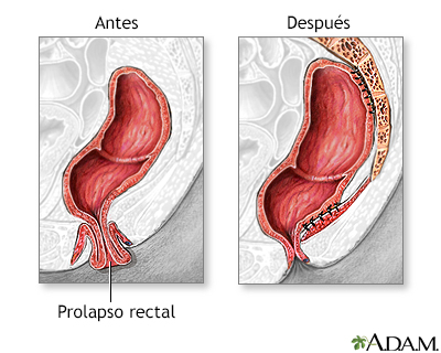 Cuidados postoperatorios