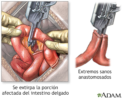 Procedimiento