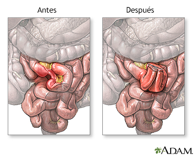 Cuidados postoperatorios