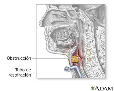 Procedimiento