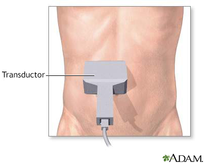 Ultrasonido abdominal