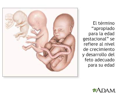 Edades gestacionales