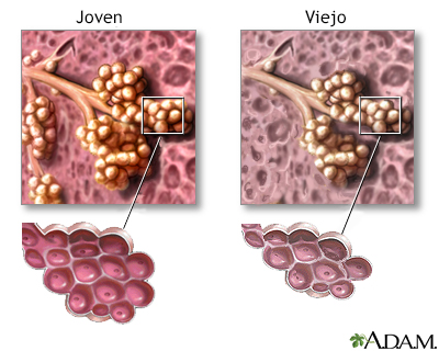 Cambios en el tejido pulmonar por el envejecimiento