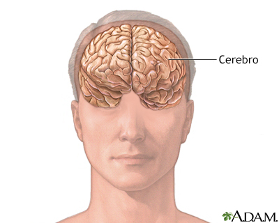 Anatomía de un cerebro normal