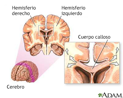 Cuerpo calloso del cerebro