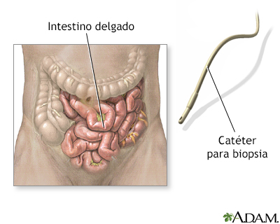 Biopsia del intestino delgado