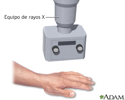 Rayos X de la mano