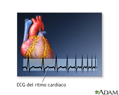 Biorretroalimentación