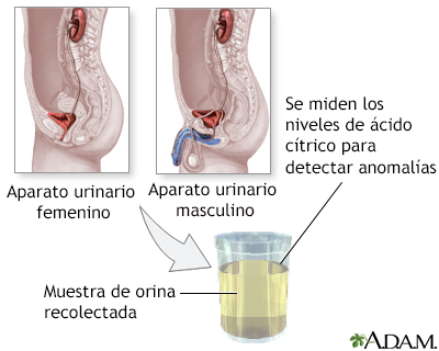 Prueba del ácido cítrico en la orina