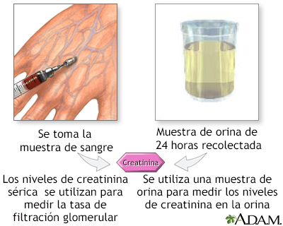 Pruebas de creatinina