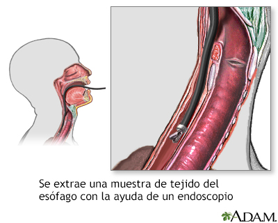 Cultivo de tejido esofágico