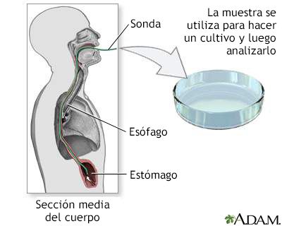 Cultivo de tejido gástrico