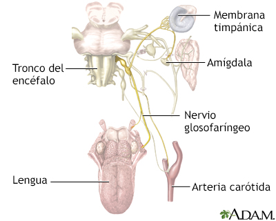 Neuralgia glosofaríngea