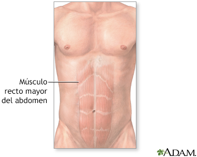 Músculos abdominales