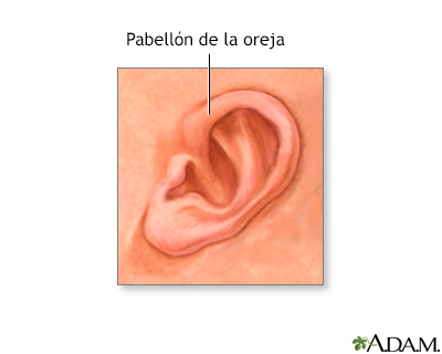 Pabellón auricular de un recién nacido