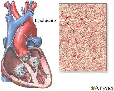 Lipofucsina