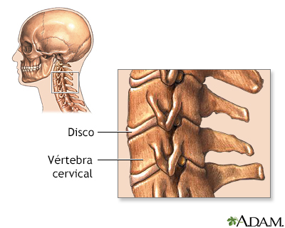 Vértebras cervicales