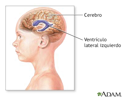 Ventrículos del cerebro