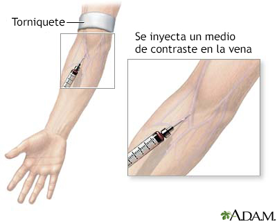 Examen MUGA