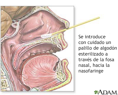 Cultivo nasofaríngeo