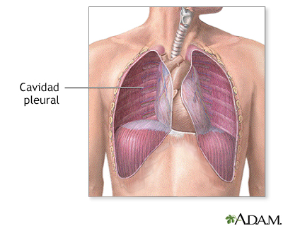 Cavidad pleural