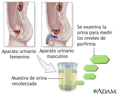 Prueba de porfirina en la orina