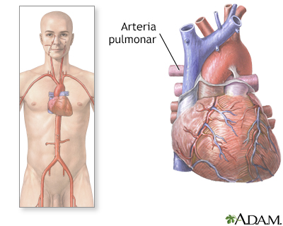 Arterias pulmonares