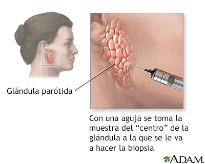 Biopsia de glándula salival