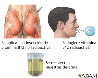 Examen de Schilling