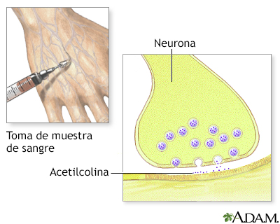 Examen de colinesterasa