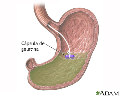 Cápsula de gelatina en el estómago