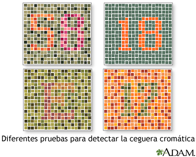 Color blindness tests