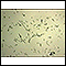 Organismo Campylobacter jejuni