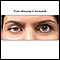 Ptosis - drooping of the eyelid