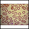 Malaria, microscopic view of cellular parasites