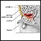 Patent urachus repair - series