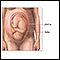 Cesarean section - series