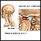 Causes of secondary headache