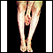 Dermatitis - herpetiformis on the arm and legs