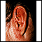 Tinea corporis - ear