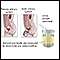 Aldosterone level test