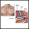 Thoracic outlet anatomy