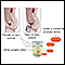 Amylase urine test