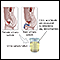 Citric acid urine test